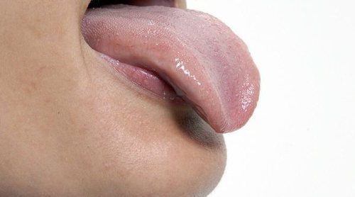 Por qué salen las llagas en la lengua