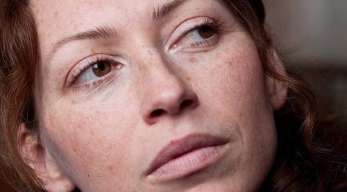 Qué es la parálisis facial
