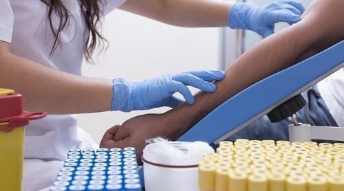 La dislipidemia; todo lo que tienes que saber