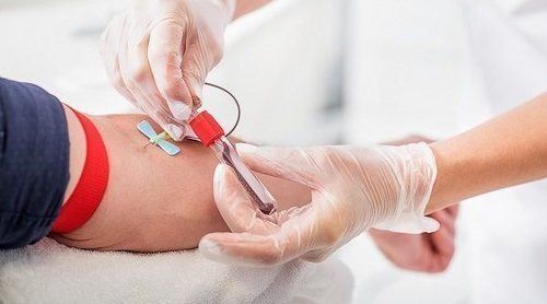 Diferencias entre sangre venosa y sangre arterial