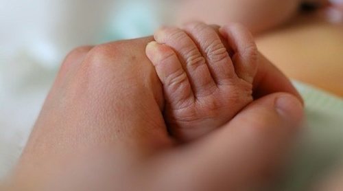 Qué es el Síndrome de Apert