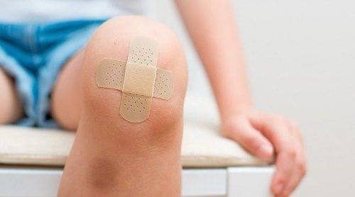 ¿Es posible tener alergia a las tiritas o a los adhesivos?