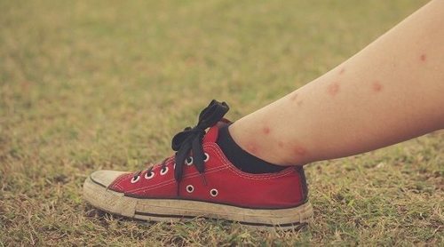 Por qué te pican a ti más los mosquitos