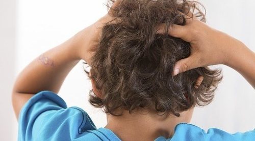 Piojos y liendres: prevención, contagio y tratamientos