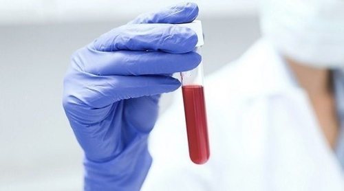 Qué debes comer de acuerdo a tu tipo de sangre