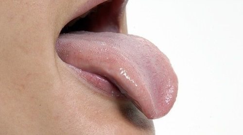 Lengua saburral, ¿es algo por lo que preocuparse?