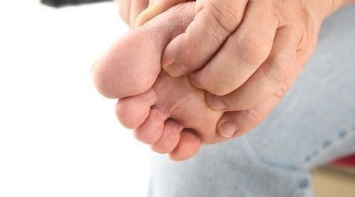 Medicamentos antimicóticos: para qué sirven