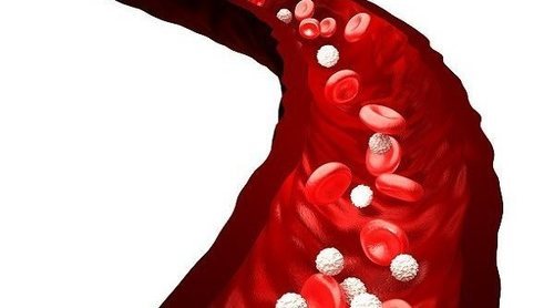 Glóbulos blancos y problemas de salud