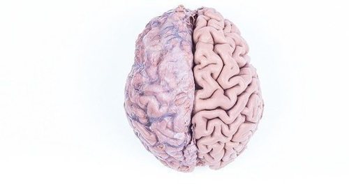 Qué es la hipoplasia y qué tipos existen