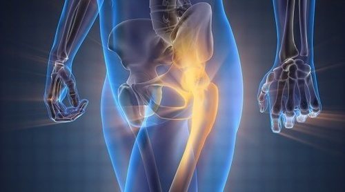 ¿Tienes osteoporosis? Señales que te advierten