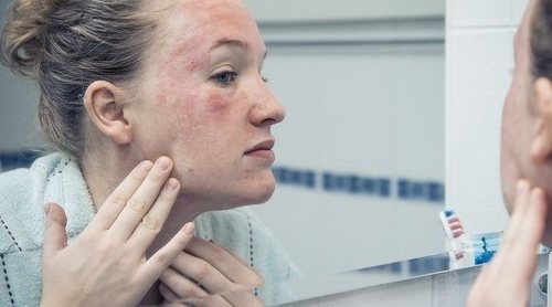 Qué es el trastorno psicosomático