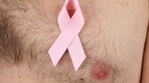Cáncer de mama en los hombres, ¿hay factores que mejoran los resultados?